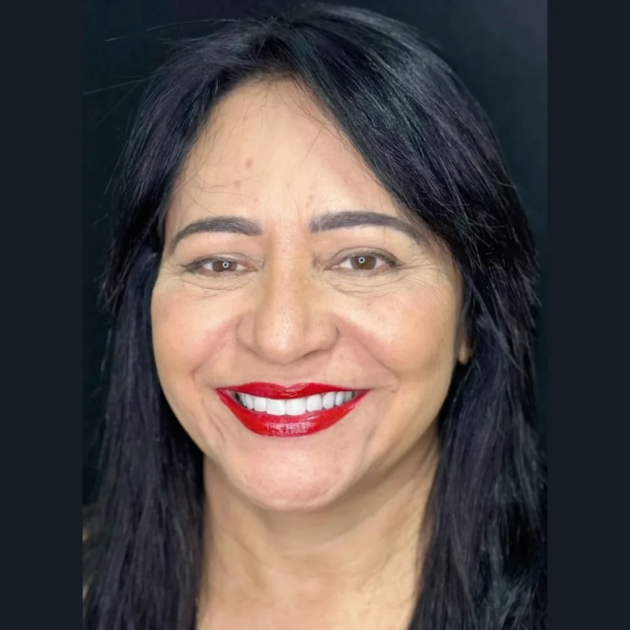 Sorriso reabilitado após tratamento na CNO